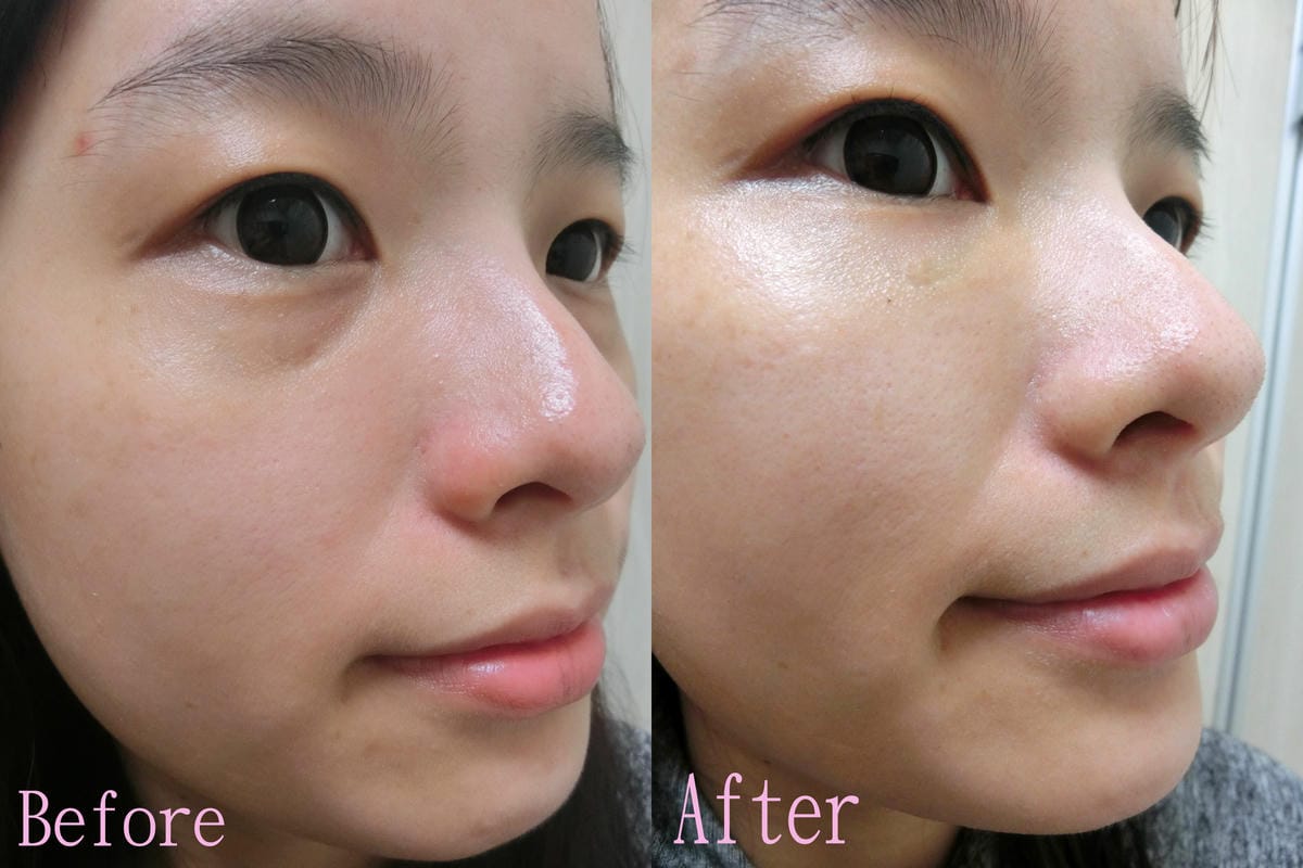 before before