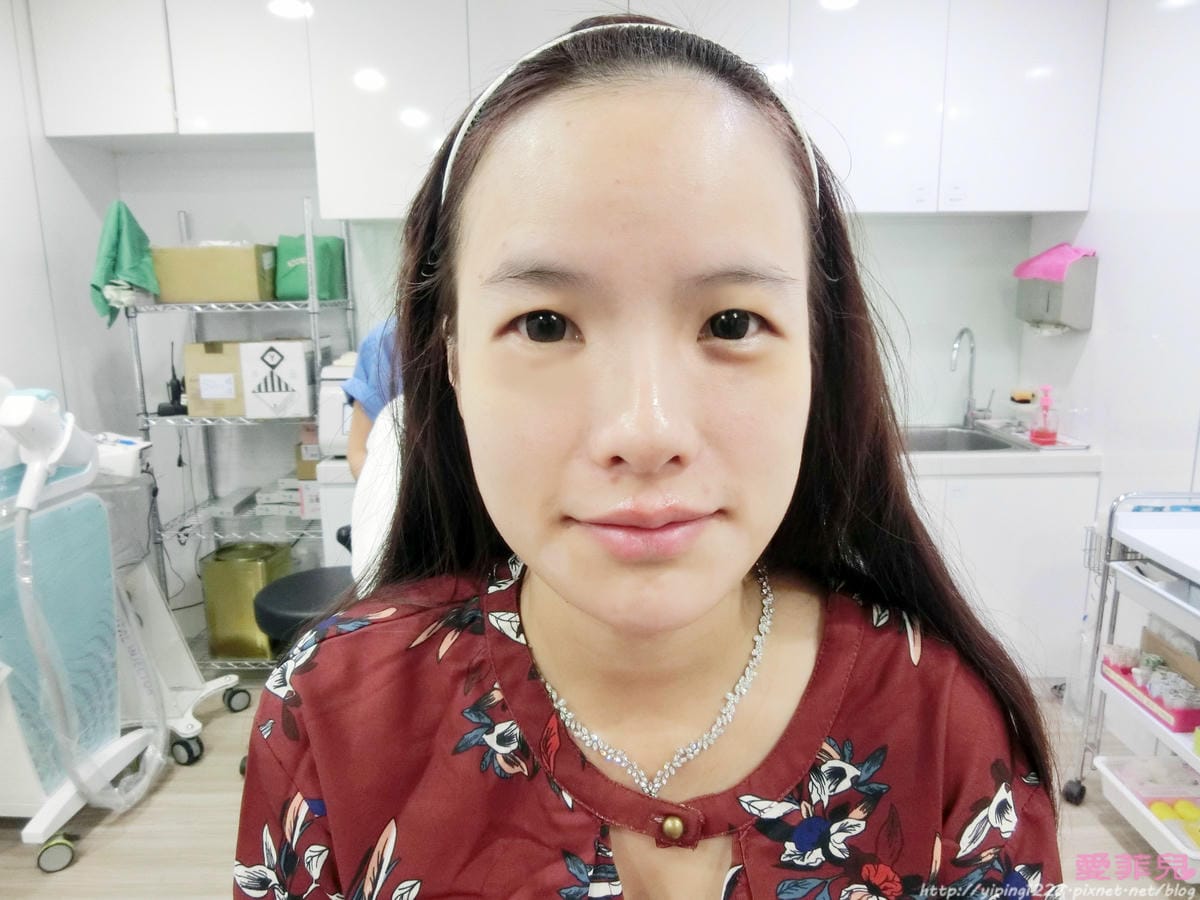 豐唇 豐唇