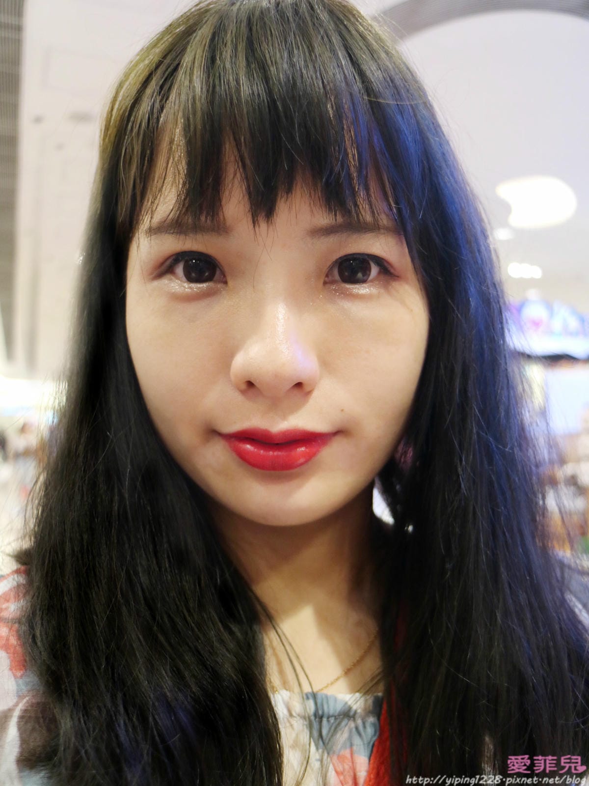 豐唇/補淚溝/美麗爾 豐唇/補淚溝/美麗爾