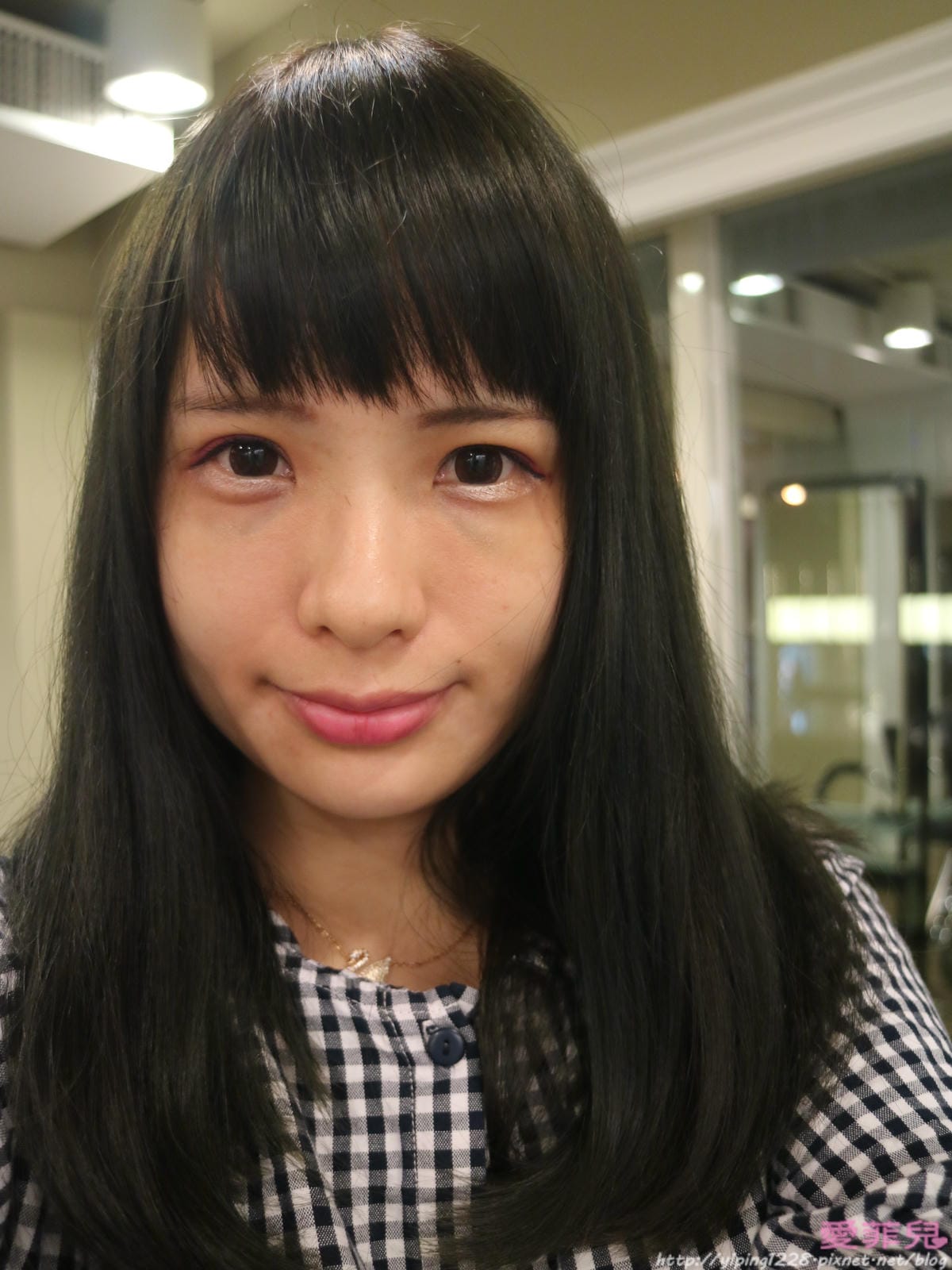 豐唇/補淚溝/美麗爾 豐唇/補淚溝/美麗爾