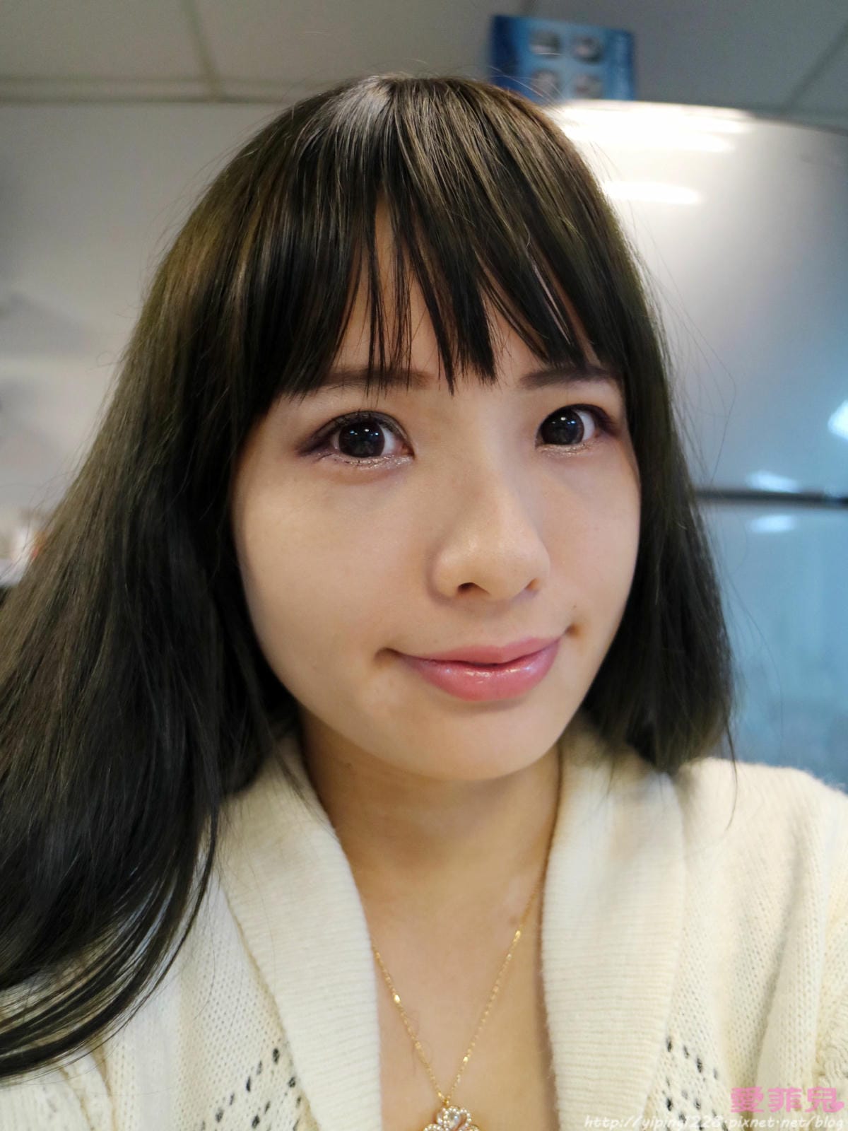 豐唇/補淚溝/美麗爾 豐唇/補淚溝/美麗爾