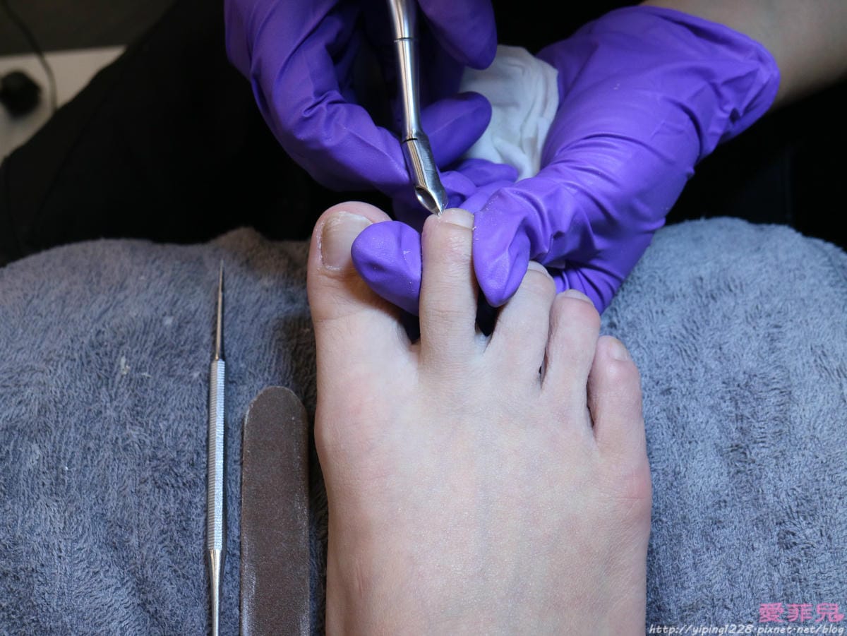 nail
