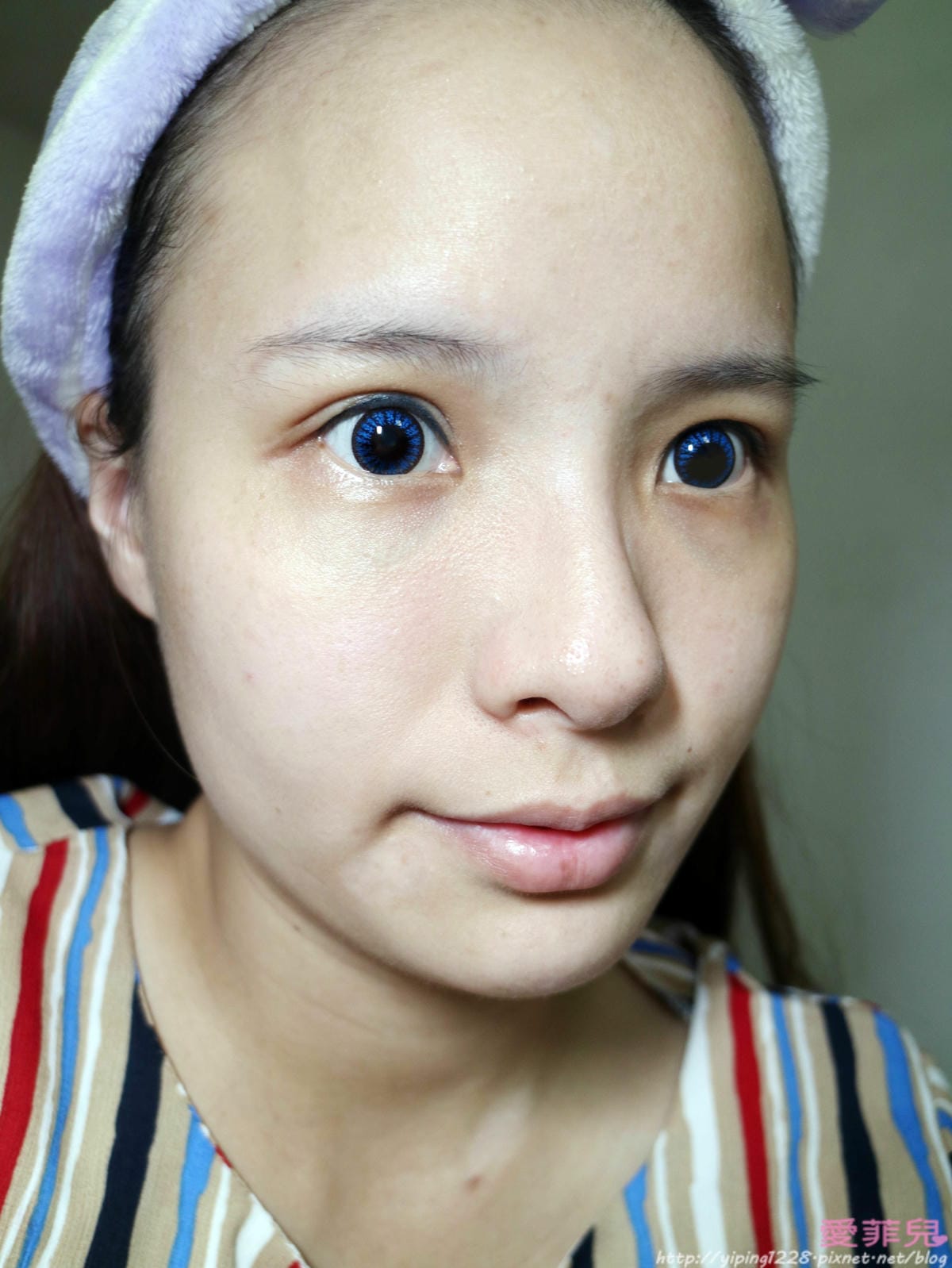 蘋果肌斷層 台北小巨蛋院所-醫美診所推薦