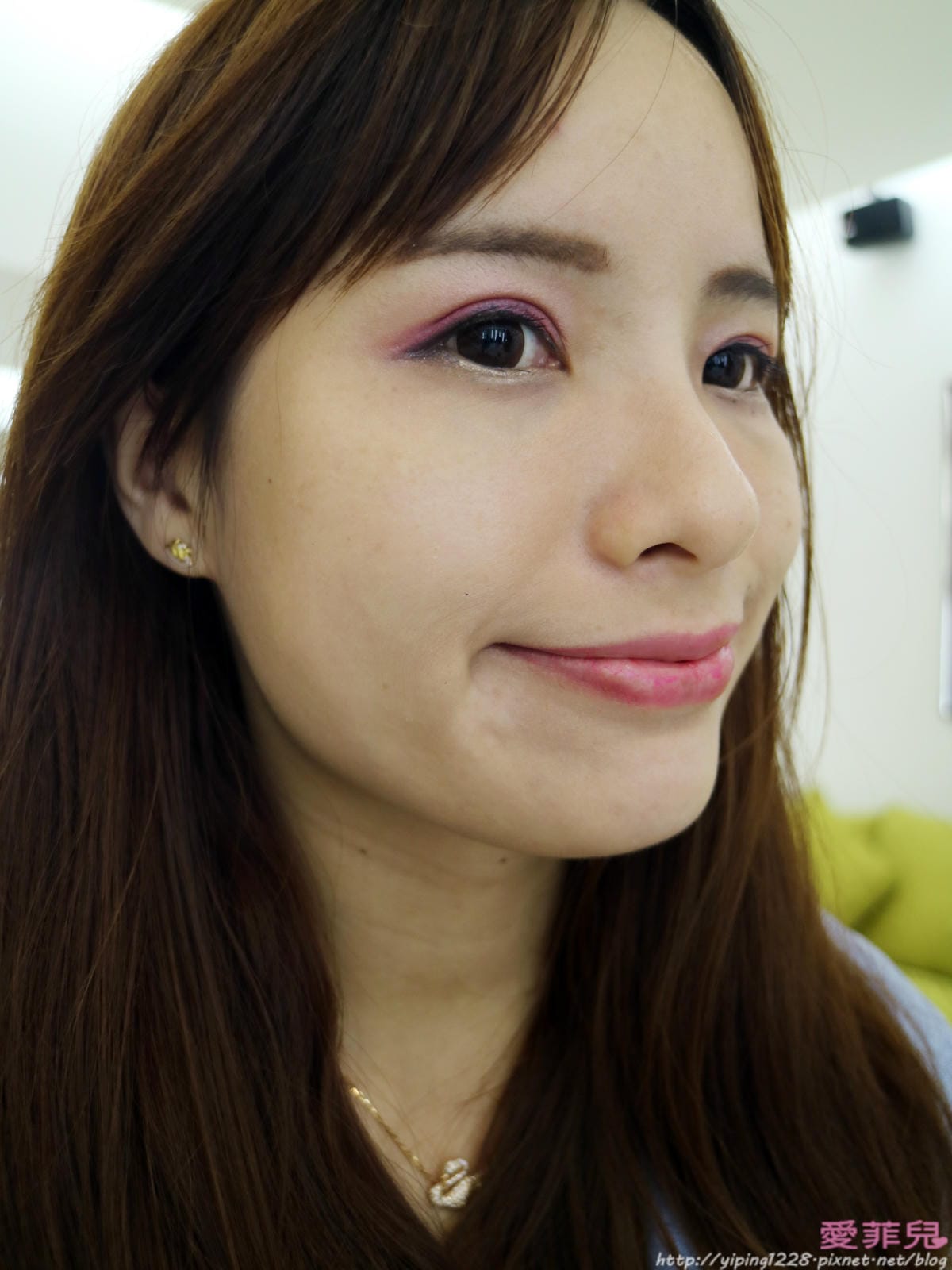 台北醫美診所推薦 ulthera美國音波拉提-醫美診所推薦