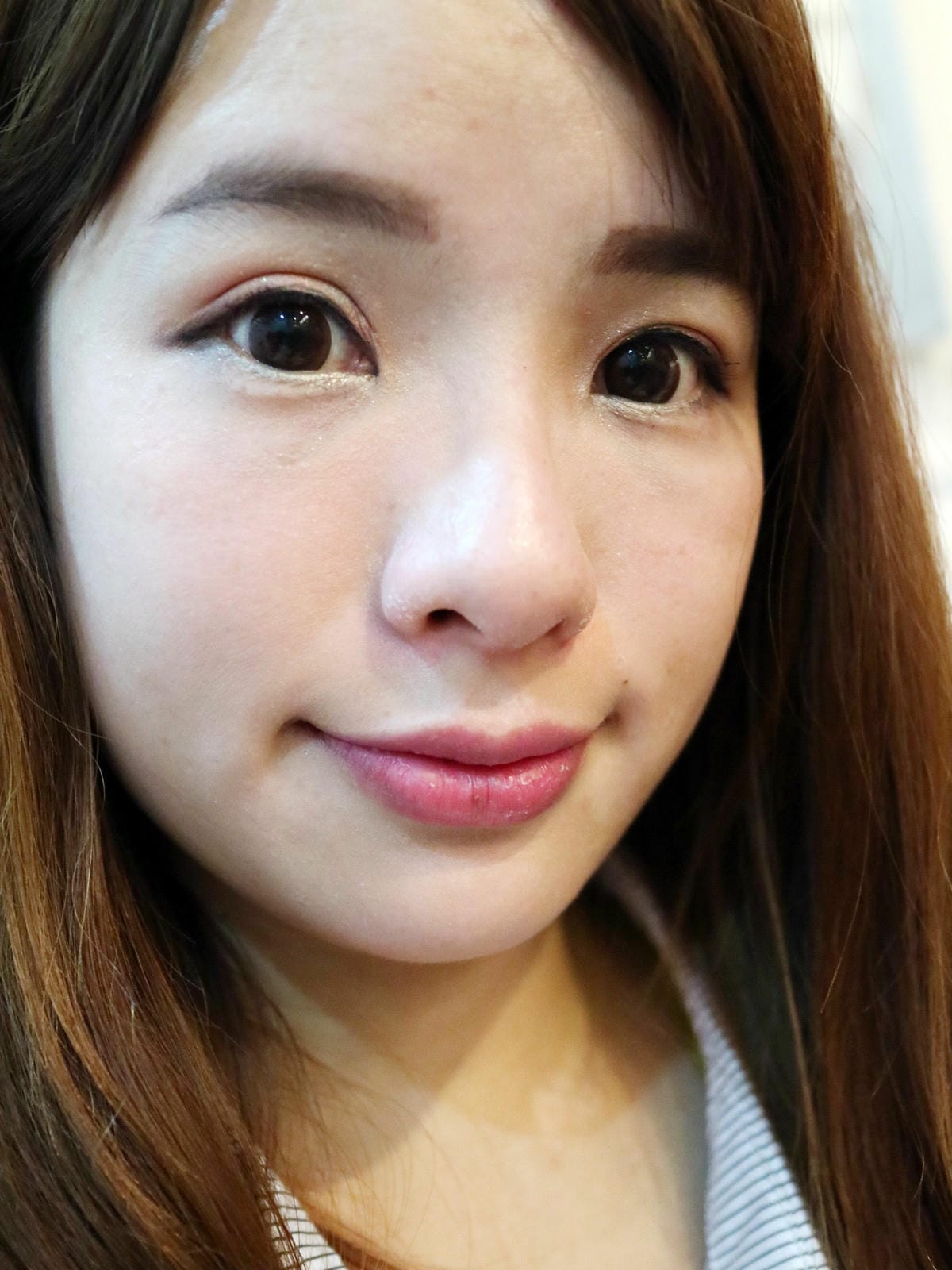 填補Princess公主玻尿酸+FONTONA4D美塑拉提(口內雷射)→讓雙下巴不再出來見人！BY~忠孝雅美姬時尚診所