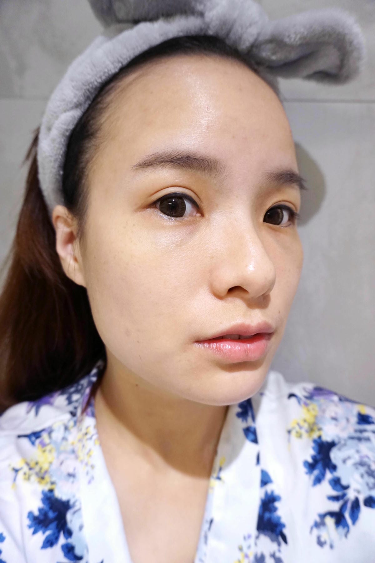 bicelle ace精華/全效維他命B5/Advanced ACE Serum全效維他命ACE bicelle ace精華/全效維他命B5/Advanced ACE Serum全效維他命ACE