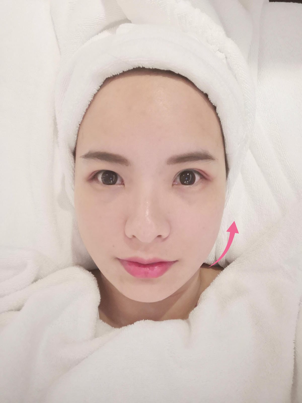 LPG推薦/東區醫美整形外科診所/佳醫美人 LPG推薦/東區醫美整形外科診所/佳醫美人