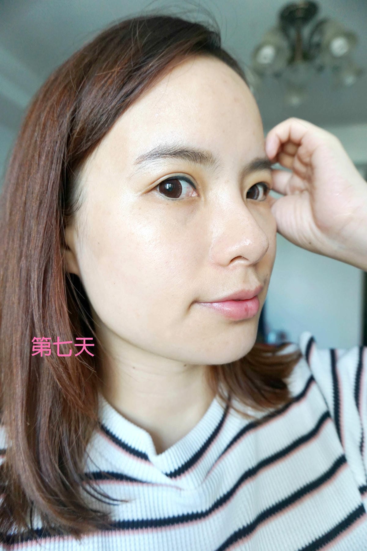 佳醫美人/皮秒雷射 佳醫美人/皮秒雷射