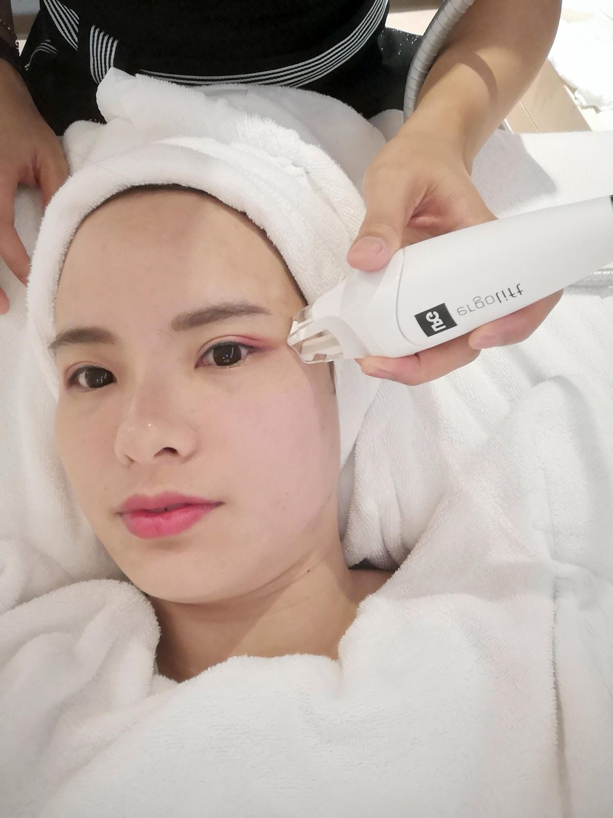 LPG推薦/東區醫美整形外科診所/佳醫美人 LPG推薦/東區醫美整形外科診所/佳醫美人