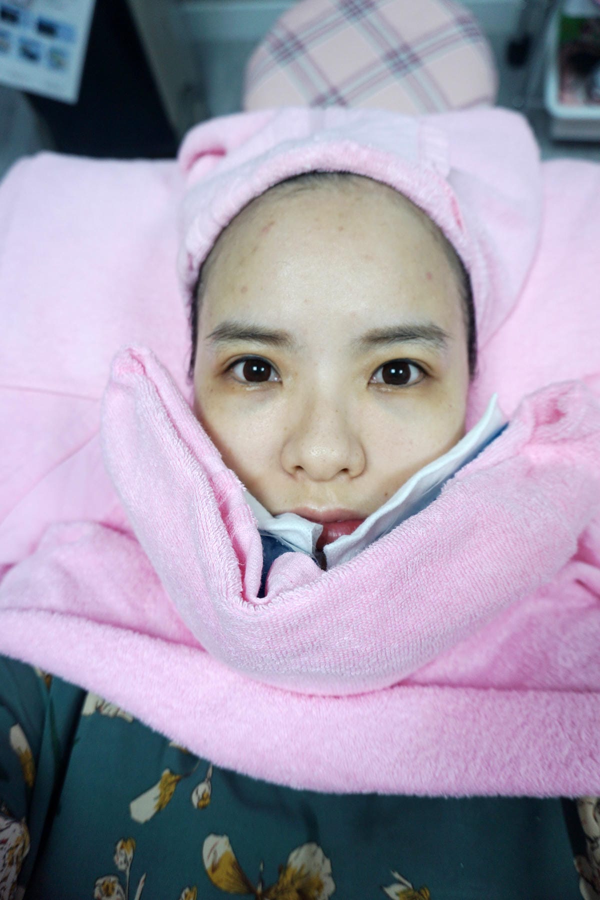 尚緹診所/M22彩衝光/肉毒桿菌/改善暗沉/小臉/雷射