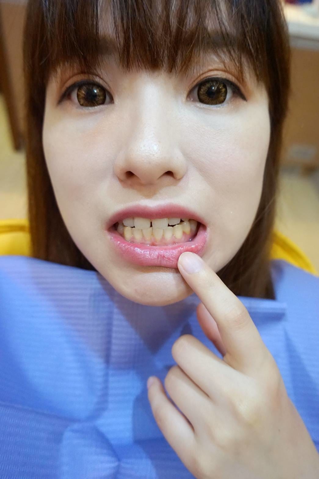 兒童牙醫/牙齒冷光美白診所推薦&rarr;怡登維美牙醫診所林葳醫師|6年牙醫專業訓練！