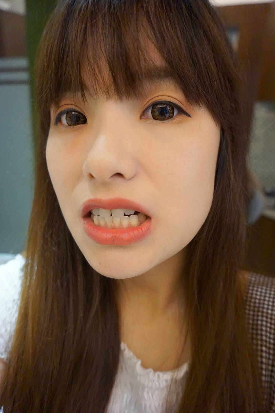 兒童牙醫/牙齒冷光美白診所推薦&rarr;怡登維美牙醫診所林葳醫師|6年牙醫專業訓練！