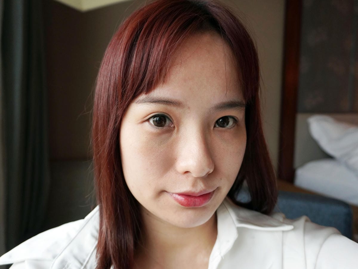 樂菲時尚診所/動態玻尿酸/補淚溝/新莊醫美診所推薦 樂菲時尚診所/動態玻尿酸/補淚溝/新莊醫美診所推薦