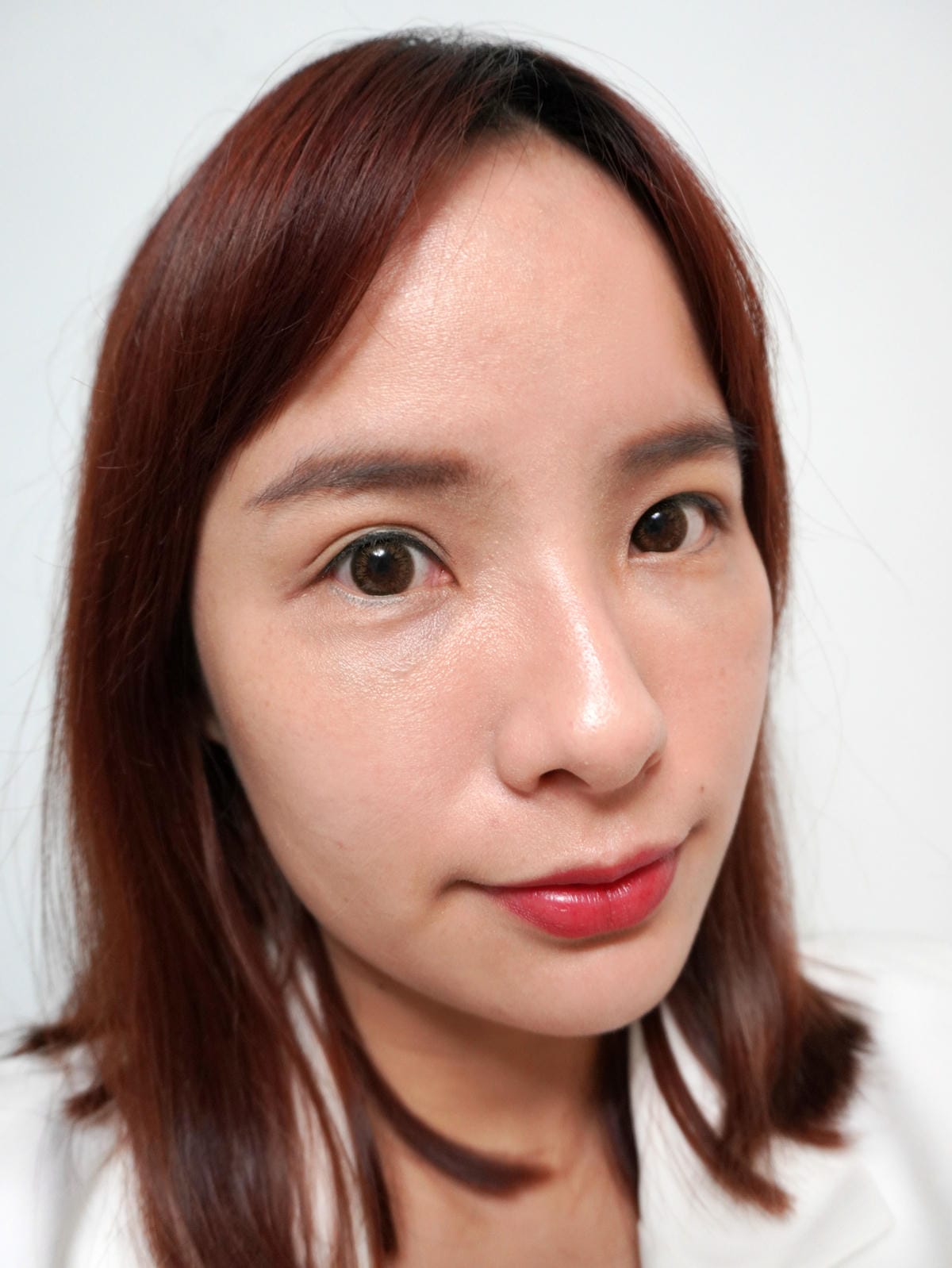 樂菲時尚診所/動態玻尿酸/補淚溝/新莊醫美診所推薦 樂菲時尚診所/動態玻尿酸/補淚溝/新莊醫美診所推薦
