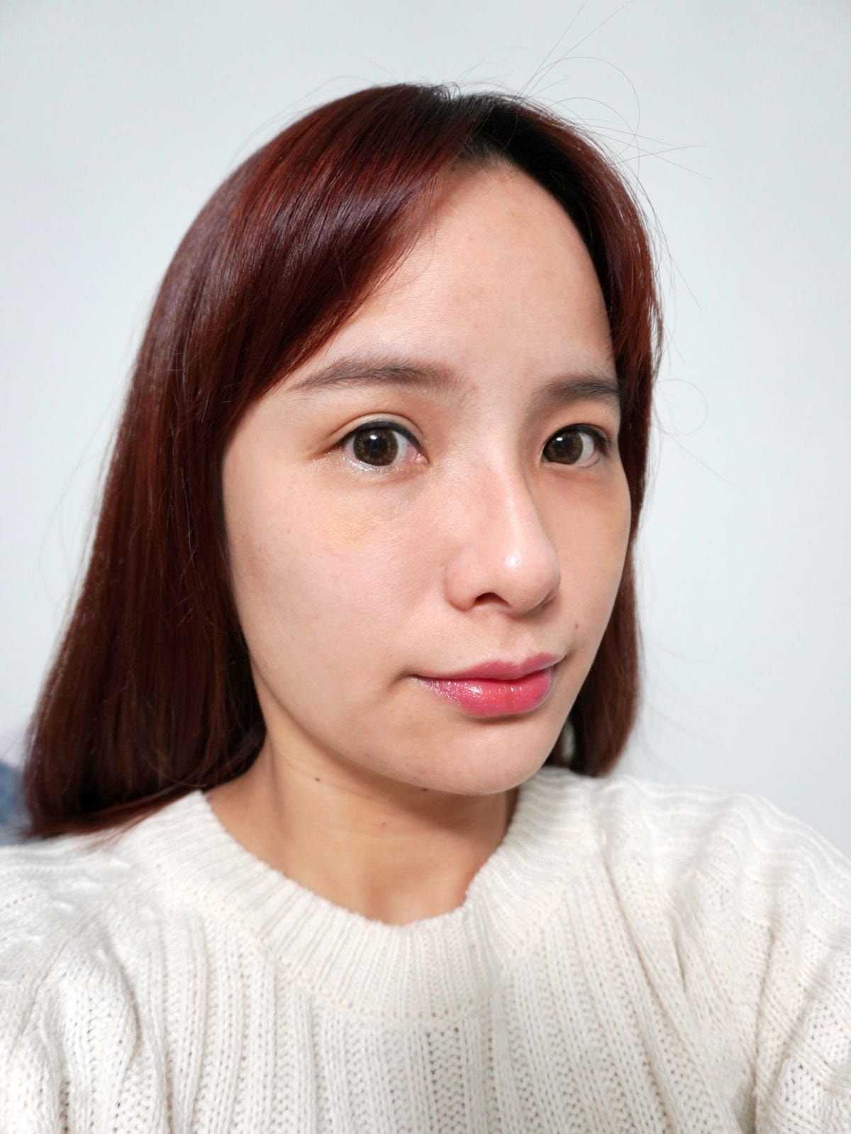 樂菲時尚診所/動態玻尿酸/補淚溝/新莊醫美診所推薦 樂菲時尚診所/動態玻尿酸/補淚溝/新莊醫美診所推薦
