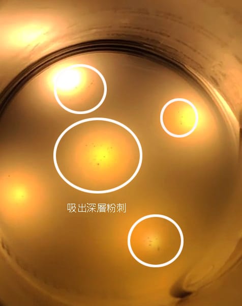 海菲秀 HydraFacial Taiwan/美國原裝進口溶液/全球水潤煥膚領導品牌/肌膚保濕發光/令人羨慕的膚質/上立皮膚科診所/ 海菲秀 HydraFacial Taiwan/美國原裝進口溶液/全球水潤煥膚領導品牌/肌膚保濕發光/令人羨慕的膚質/上立皮膚科診所/