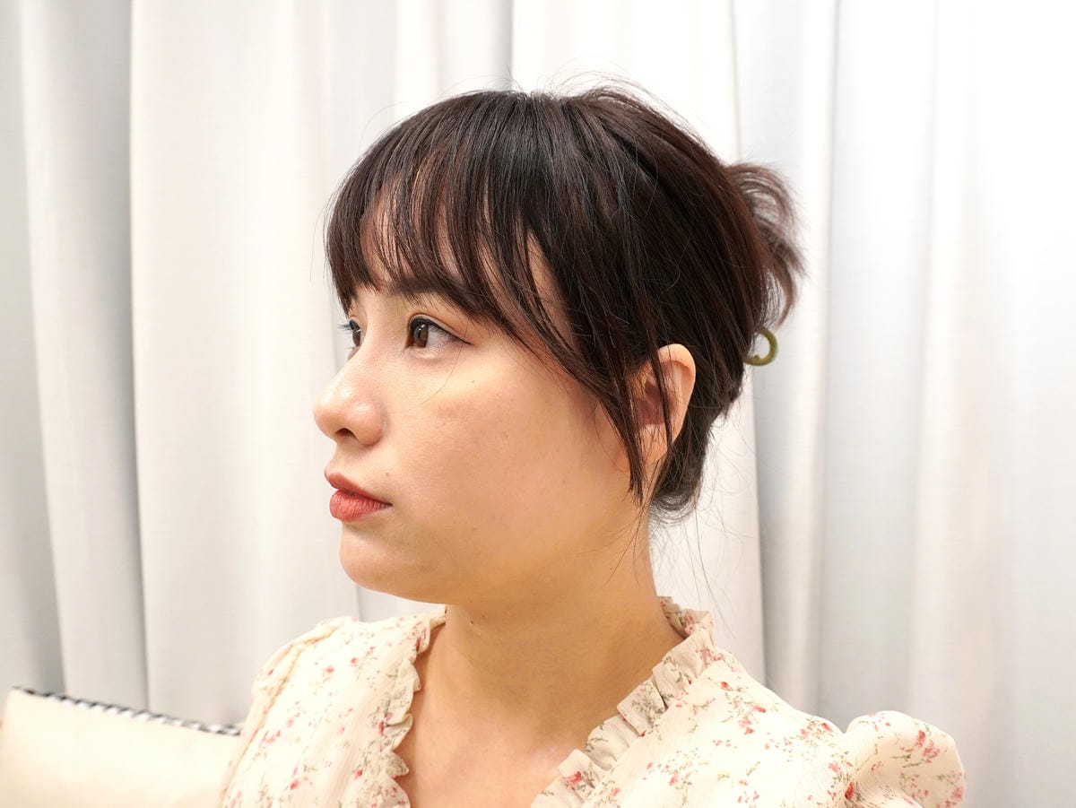 立特拉渦旋音波拉提2.0→拉出韓星小V臉!BY立健美診所 立特拉渦旋音波拉提2.0→拉出韓星小V臉!BY立健美診所