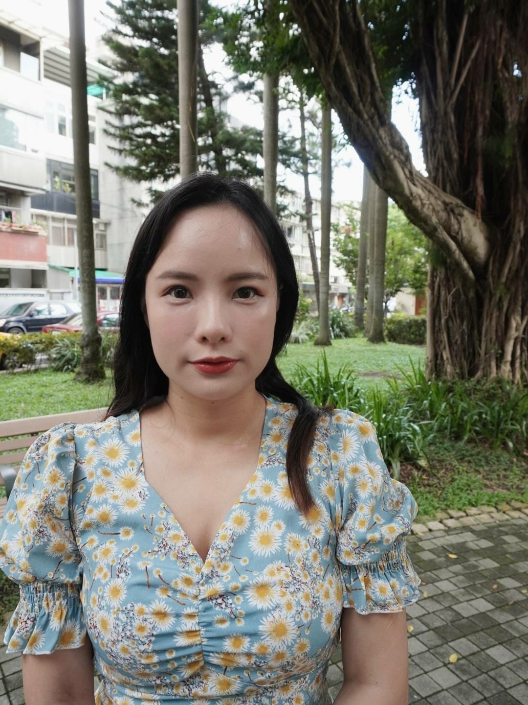 大安捷運站醫美診所推薦-從國字臉到精緻V臉：幸衍醫美小臉轉變記錄